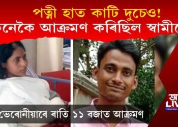 পত্নী হাত কাটি দুচেও! কিয় কৰিলে দুচেও? প্ৰকৃত কাৰণ প্ৰকাশ কৰিলে স্বামীয়ে