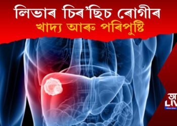 লিভাৰ চিৰ’ছিচ ৰোগীৰ খাদ্য আৰু পৰিপুষ্টি