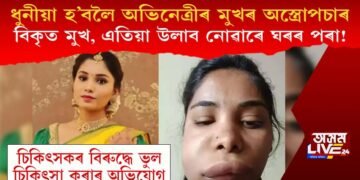 ধুনীয়া হ’বলৈ অভিনেত্ৰীৰ মুখৰ অস্ত্ৰোপচাৰ! বিকৃত হৈ এতিয়া ঘৰৰ পৰা উলাব নোৱাৰাৰ অৱস্থা