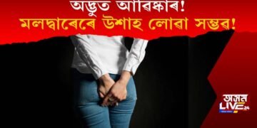 অদ্ভুত আৱিষ্কাৰ! মলদ্বাৰেৰে উশাহ লোৱা সম্ভৱ! এক গৱেষণাৰ দাবী