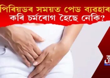 পিৰিয়ডৰ সময়ত পেড ব্যৱহাৰ কৰি চৰ্মৰোগ হৈছে নেকি? ঘৰুৱা উপায়েৰে তৎক্ষণাত সকাহ পাওক