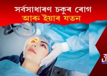 সৰ্বসাধাৰণ চকুৰ ৰোগ আৰু ইয়াৰ যতন