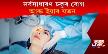 সৰ্বসাধাৰণ চকুৰ ৰোগ আৰু ইয়াৰ যতন