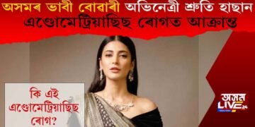 এণ্ডোমেট্ৰিয়াছিছ ৰোগত আক্ৰান্ত অভিনেত্ৰী শ্ৰুতি হাছান! কি এই ৰোগ?