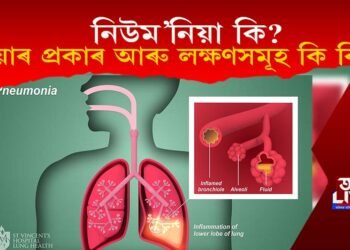 নিউম’নিয়া কি? ইয়াৰ প্ৰকাৰ আৰু লক্ষণসমূহ কি কি?