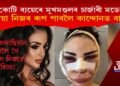 ৫ কোটিৰে অস্ত্ৰোপচাৰ কৰি কিম কাৰ্দাছিয়ান হ’বলৈ গৈ এতিয়া নিজৰে ৰূপ দেখি ক্ৰন্দৰত এইগৰাকী মডেল