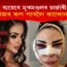 ৫ কোটিৰে অস্ত্ৰোপচাৰ কৰি কিম কাৰ্দাছিয়ান হ’বলৈ গৈ এতিয়া নিজৰে ৰূপ দেখি ক্ৰন্দৰত এইগৰাকী মডেল