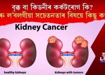 বৃক্ক বা কিডনীৰ কৰ্কটৰোগ কি? আৰু ল’বলগীয়া সচেতনতাৰ বিষয়ে কিছু কথা…
