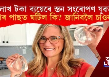 ২৩ লাখ টকা ব্যয়েৰে স্তন সংৰোপণ মহিলাৰ! তাৰ পাছত ঘটিল কি? জানিবলৈ চাওক…
