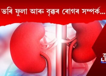 ভৰি ফুলা আৰু বৃক্কৰ ৰোগৰ সম্পৰ্ক…