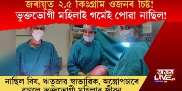 জৰায়ুত ২.৫ কিঃগ্ৰাম ওজনৰ চিষ্ট! ভুক্তভোগী মহিলাই গমেই পোৱা নাছিল! অস্ত্ৰোপচাৰে বচালে জীৱন