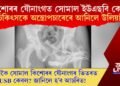কিশোৰৰ যৌনাংগত সোমাল ইউএছবি কেবল, চিকিৎসকে অস্ত্ৰোপচাৰেৰে আনিলে উলিয়াই