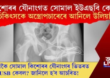 কিশোৰৰ যৌনাংগত সোমাল ইউএছবি কেবল, চিকিৎসকে অস্ত্ৰোপচাৰেৰে আনিলে উলিয়াই