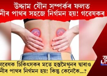 উদ্দাম যৌন সম্পৰ্কৰ ফলত কিডনীৰ পাথৰ সহজে নিৰ্গমন হয়! গৱেষণকৰ দাবী