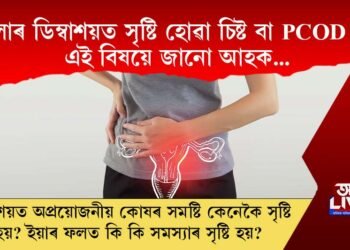 মহিলাৰ ডিম্বাশয়ত সৃষ্টি হোৱা চিষ্ট বা PCOD কি? এই বিষয়ে জানো আহক…