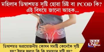 মহিলাৰ ডিম্বাশয়ত সৃষ্টি হোৱা চিষ্ট বা PCOD কি? এই বিষয়ে জানো আহক…