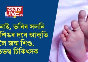 ভৰি নাই, ভৰিৰ সলনি জন্তু শিঙৰ দৰে আকৃতি লৈ জন্ম শিশুৰ, হতভম্ব চিকিৎসকসহ মাতৃ