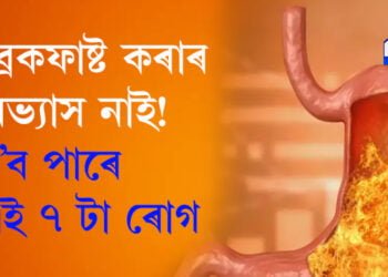 ব্ৰেকফাষ্ট কৰাৰ অভ্যাস নাই! এই ৭ টা ৰোগৰ স্বীকাৰ হ’ব আপুনিও…