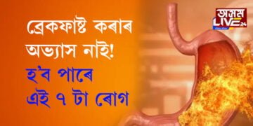 ব্ৰেকফাষ্ট কৰাৰ অভ্যাস নাই! এই ৭ টা ৰোগৰ স্বীকাৰ হ’ব আপুনিও…