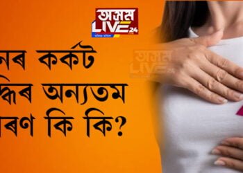 মহিলাৰ স্তনৰ কৰ্কট বৃদ্ধিৰ অন্যতম কাৰণ কেইটা কি কি?