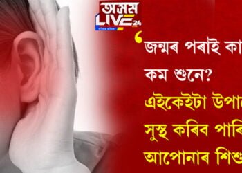 জন্মৰ পৰাই কাণেৰে কম শুনে? এইকেইটা উপায়েৰে সুস্থ কৰি তুলিব পাৰিব আপোনাৰ শিশুটিক…