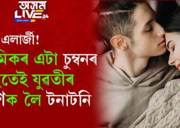 চুম্বন এলাৰ্জী! প্ৰেমিকৰ এটা চুম্বনৰ পিছতেই যুৱতীৰ প্ৰাণক লৈ টনাটনি