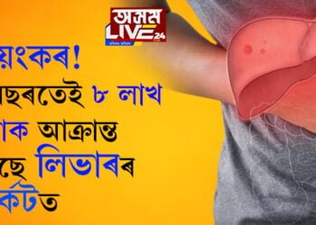 সমীক্ষাত প্ৰকাশ! ২০৪০ লৈ লিভাৰৰ কৰ্কটত আক্ৰান্ত হৈ মৃত্যু হোৱা লোকৰ সংখ্যা ৫৫ শতাংশলৈ বাঢ়িব। কেনেকৈ নিয়ন্ত্ৰণ কৰিব জানিবলৈ চাওক…