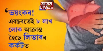 সমীক্ষাত প্ৰকাশ! ২০৪০ লৈ লিভাৰৰ কৰ্কটত আক্ৰান্ত হৈ মৃত্যু হোৱা লোকৰ সংখ্যা ৫৫ শতাংশলৈ বাঢ়িব। কেনেকৈ নিয়ন্ত্ৰণ কৰিব জানিবলৈ চাওক…