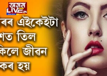 শৰীৰৰ এইকেইটা অংশত তিল থাকিলে অত্যন্ত শুভ, কোনকেইটা স্থানত তিল থাকিলে শুভ? জানিবলৈ ক্লিক কৰক…