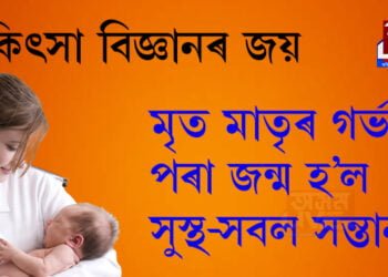 মৃত মাতৃৰ গৰ্ভৰ পৰা জন্ম হ’ল সুস্থ-সবল সন্তান, মৃত মাতৃয়ে কেনেকৈ জন্ম দিলে সন্তান, সবিশেষ পঢ়িবলৈ ক্লিক কৰক…