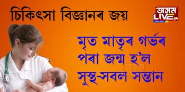 মৃত মাতৃৰ গৰ্ভৰ পৰা জন্ম হ’ল সুস্থ-সবল সন্তান, মৃত মাতৃয়ে কেনেকৈ জন্ম দিলে সন্তান, সবিশেষ পঢ়িবলৈ ক্লিক কৰক…