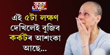 কৰ্কটৰ পৰা সাৱধান! এই ৫ লক্ষণে দেখা দিলে তাৎক্ষণিকভাবে চিকিৎসকৰ পৰামৰ্শ গ্ৰহণ কৰিবই