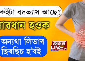সুৰাপান নকৰিলেও এইকেইটা বদভ্যাস থাকিলে আপোনাৰ লিভাৰৰ ছিৰছিচ হ’বই…