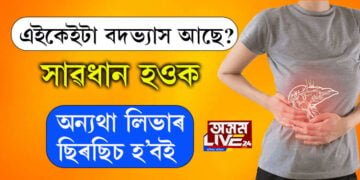 সুৰাপান নকৰিলেও এইকেইটা বদভ্যাস থাকিলে আপোনাৰ লিভাৰৰ ছিৰছিচ হ’বই…
