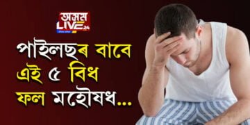 কোষ্ঠকাঠিন্যৰ সমস্যাই বঢ়াই অৰ্শৰ ভয়াৱহতা! পাইলছৰ সমস্যাত ভুগিলে এই ৫ বিধ ফল খাবই…