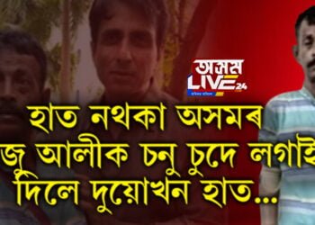 অসহায় লোকৰ বাবে তেওঁ ভগৱান! হাত নথকা অসমৰ ৰাজু আলীক চনু চুদে লগাই দিলে দুয়োখন হাত…
