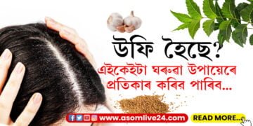 শীত কালত চুলি সৰা, উফি হোৱা বৃহৎ এক সমস্যা! ঘৰুৱা উপায়েৰে কেনেকৈ সমাধা কৰিব?