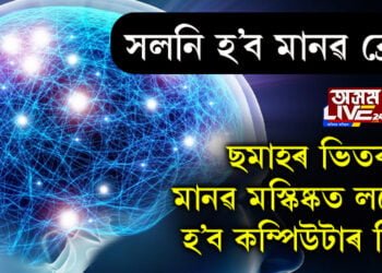 সলনি হ’ব মানৱ ব্ৰেইন! ছমাহৰ ভিতৰতেই মানৱ মস্কিষ্কত লগোৱা হ’ব কম্পিউটাৰ চিপ…