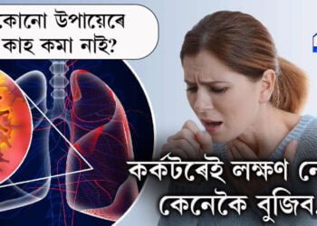 কোনো উপায়েৰেই কাহ কমা নাই? হাওঁফাওঁৰ কৰ্কটৰেই লক্ষণ নেকি? কেনেকৈ বুজিব, সবিশেষ…