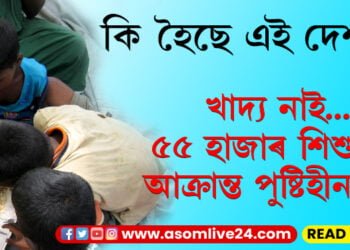 এবছৰৰ ভিতৰত ৫৫ হাজাৰ শিশু আক্ৰান্ত হৈছে পুষ্টিহীনতাত! কি হৈছে এই দেশত?