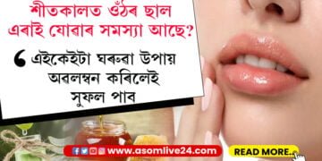 শীতকালত ওঁঠ ফটাৰ সমস্যা আছে! এইকেইটা ঘৰুৱা উপায় অৱলম্বন কৰিলেই দূৰ হ’ব এই সমস্যা…