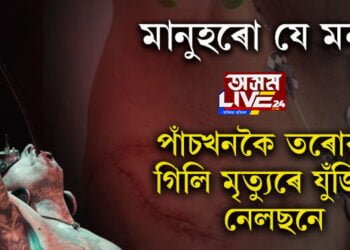 পাঁচখনকৈ তৰোৱাৰ অনায়াসেই গিলি দিছিল! পেটৰ বিভিন্ন অংশ টুকুৰা-টুকুৰ হৈ পৰা নেলছনে যুঁজিছে মৃত্যুৰে, কিয় গিলিছিল তৰোৱাল? সবিশেষ…