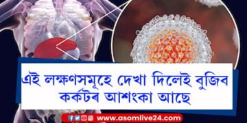 কোনবোৰ লক্ষণে দেখা দিলে কৰ্কটৰ আশংকা আছে বুলি জানিব?