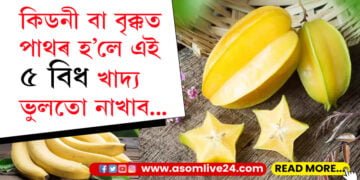 কিডনী বা বৃক্কত পাথৰ হ’লে এই ৫ বিধ খাদ্য ভুলতো নাখাব… ভিতৰে ভিতৰে বাঢ়ি যাব পাৰে এই ৰোগ