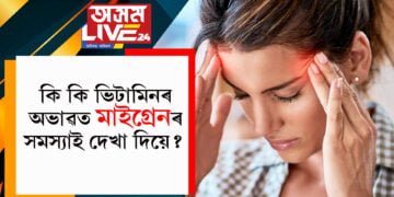 কি কি ভিটামিনৰ অভাৱত মাইগ্ৰেনৰ সমস্যাই দেখা দিয়ে?