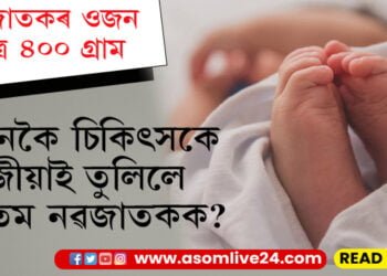 নৱজাতকৰ ওজন এটা গাখীৰৰ পেকেটতকৈও কম! ০.৫ শতাংশও আশা নাছিল জীয়াই ৰখাৰ, কেনেকৈ চিকিৎসকে জীয়াই তুলিছে দেশৰ ক্ষুদ্ৰতম নৱজাতকক?