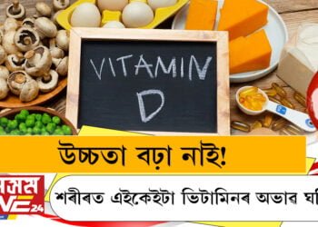 উচ্চতা বঢ়া নাই! শৰীৰত এইকেইটা ভিটামিনৰ অভাৱ ঘটিছে…