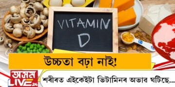 উচ্চতা বঢ়া নাই! শৰীৰত এইকেইটা ভিটামিনৰ অভাৱ ঘটিছে…