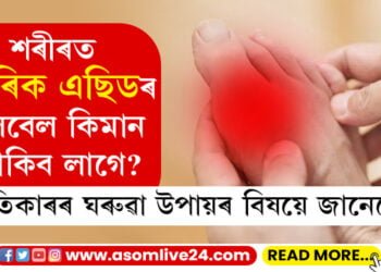 তেজত ইউৰিক এচিডৰ লেবেল কিমান হ’ব লাগে? ইউৰিক এছিড বাঢ়িলে কি ঘৰুৱা উপায়েৰে প্ৰতিকাৰ কৰিব?