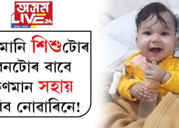 মানুহে মানুহৰ বাবে…কণমানি শিশুটোৰ জীৱনটোৰ বাবে অকণমান সহায় কৰিব নোৱাৰিনে!